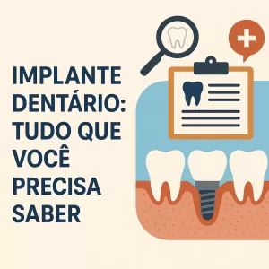 Informativo escrito " Implante Dentário: tudo que você precisa saber" com imagens ilustrativas de implantes.