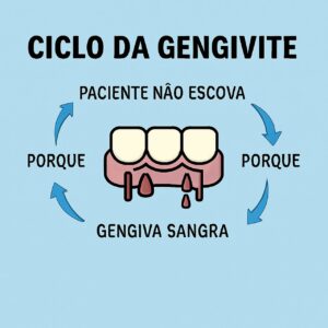 ciclo da gengivite, paciente não escova porque sangra e dai ele não escova, e então sangra.