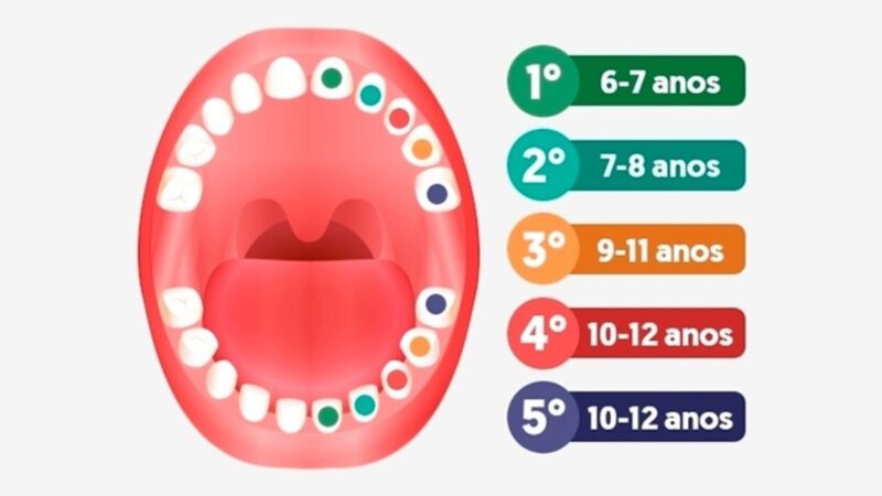 Cronologia da troca dos dentes de leite