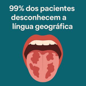 Imagem mostra uma ilustração de língua geográfica, e o texto: "99% dos pacientes desconhecem a língua geográfica".